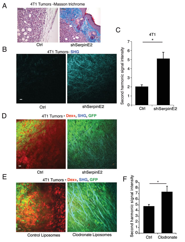 SerpinE2 controls tumor matrix density and matrix-remodeling. (