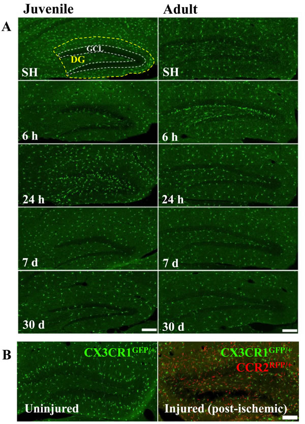 Irradiation did not recruit peripheral monocytes into the hippocampus.