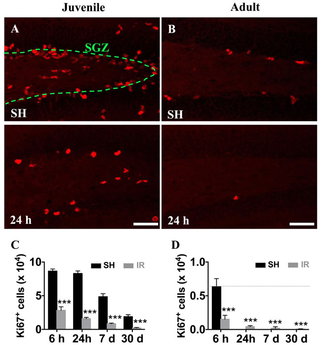 Irradiation reduced the number of hippocampal proliferating cells in both juvenile and adult brains.