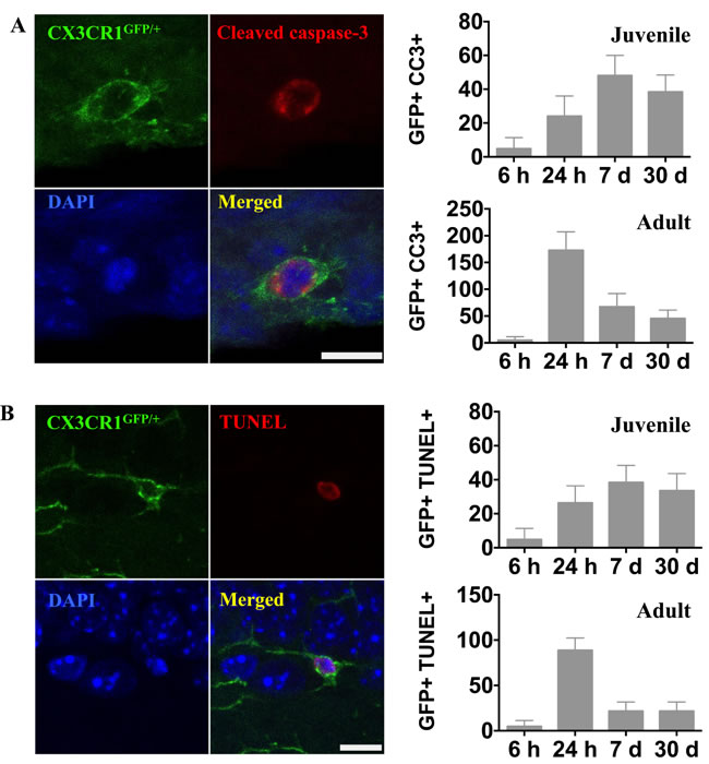 Irradiation induced microglial cell death.