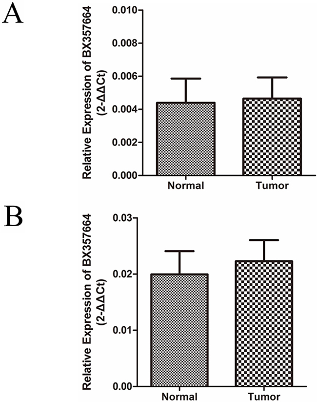 BX357664 is not differentially expressed in bladder tumor and prostate cancer.