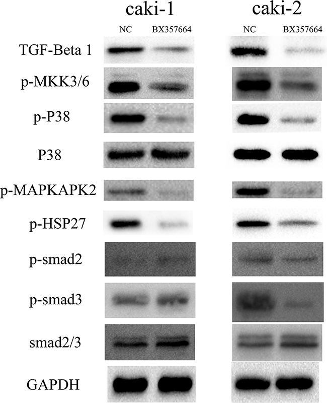 BX357664 suppresses the TGF-&#x03B2;1/p38/HSP27 pathway.