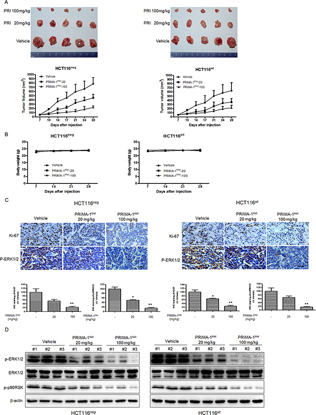 PRIMA-1Met suppresses tumor growth in vivo by inhibiting MEK activity.