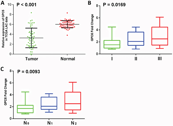 Expression levels of GPC5 in lung adenocarcinoma (LAC) and its clinical significance.