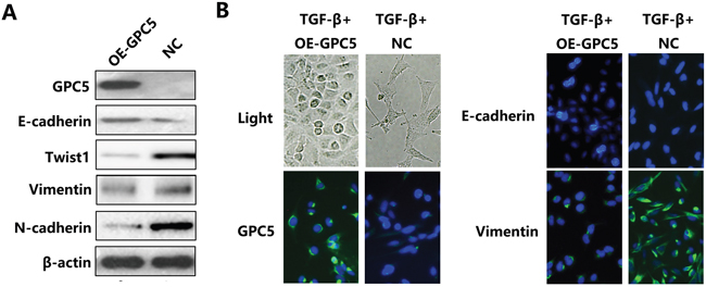 GPC5 inhibits the Epithelial-Mesenchymal Transition (EMT) process in lung adenocarcinoma cells.