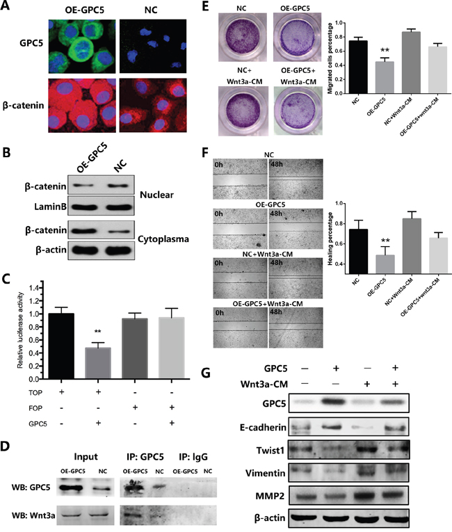GPC5 inhibits Wnt/&#x03B2;-catenin signal pathway via competitively binding to Wnt3a.