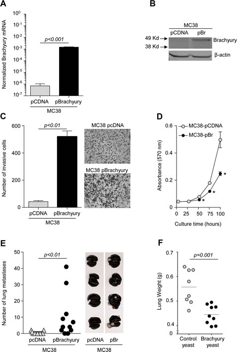 Antitumor effect of  yeast-brachyury vaccination in the MC38-brachyury metastatic tumor model.
