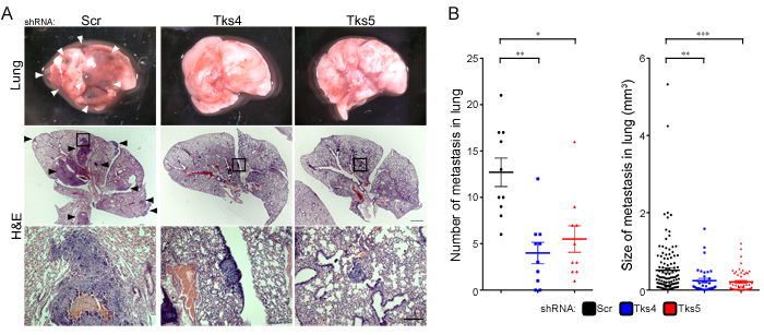 Tks adaptor proteins are required for melanoma metastasis