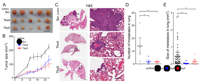 Tks adaptor proteins are required for human melanoma growth and metastasis