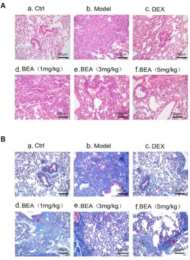 H&amp;E and Masson Trichrome staining of mouse lung tissue.