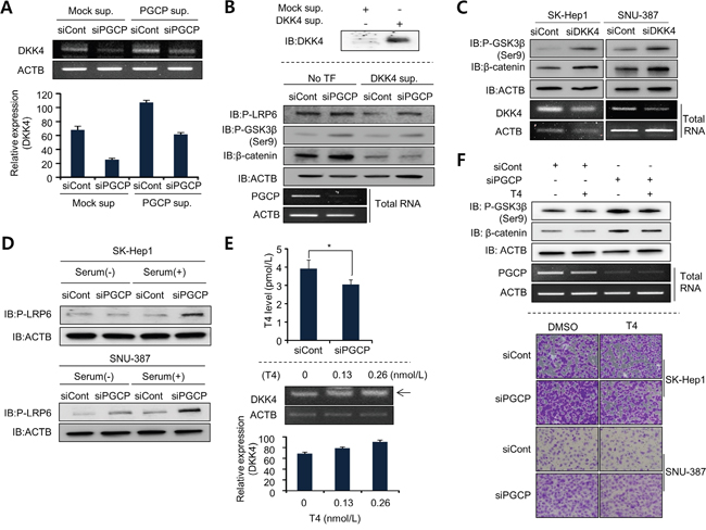 PGCP transcriptionally modulates DKK4 expression in a T4-dependent manner.