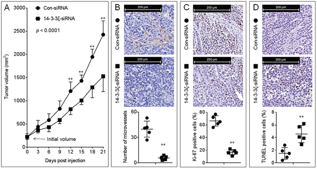 Effects of 14-3-3&#x03B6; on the growth and angiogenesis in vivo.