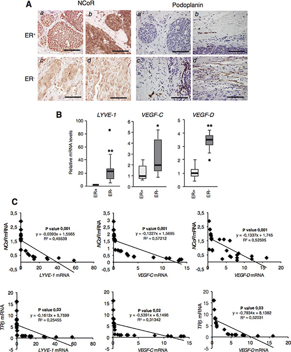 NCoR and TR&#x03B2; levels correlate negatively with lymphangiogenic gene expresion in human breast tumors.