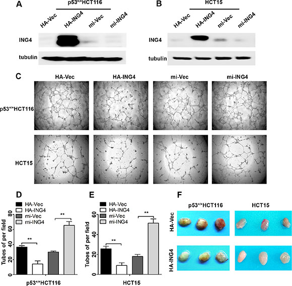 Expression of ING4 in CRC cells negatively regulated tube formation in vitro and inhibited blood vessel formation in vivo.