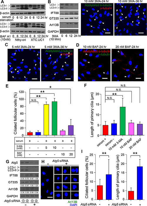 Relationship between primary ciliogenesis and autophagy in XTC.UC1 cells.