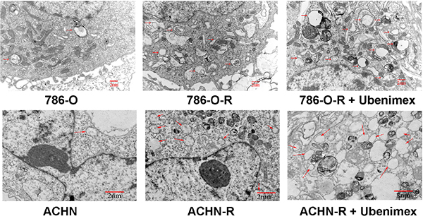 Electron microscopy of ACHN, ACHN-R, and ACHN-R+ ubenimex.