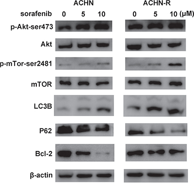 Similar changes in Western blot were found for another RCC cell line, ACHN.