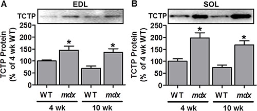 TCTP protein is elevated in dystrophic mdx mouse skeletal muscle.