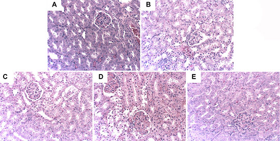 Effects of hyperin on histopathological changes in kidney tissues in LPS-induced AKI mice.