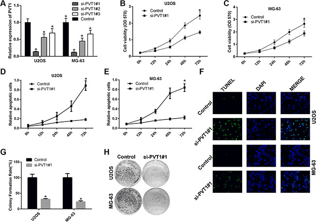 Silencing PVT1 by siRNA inhibits proliferation and promotes apoptosis in osteosarcoma cells.