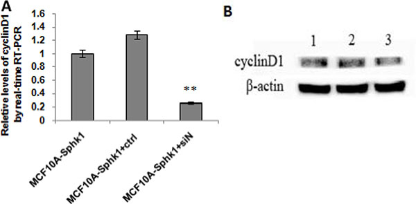 Activated Sphk1/S1P signaling and inhibited the expression of NF-&#x03BA;Bp65.