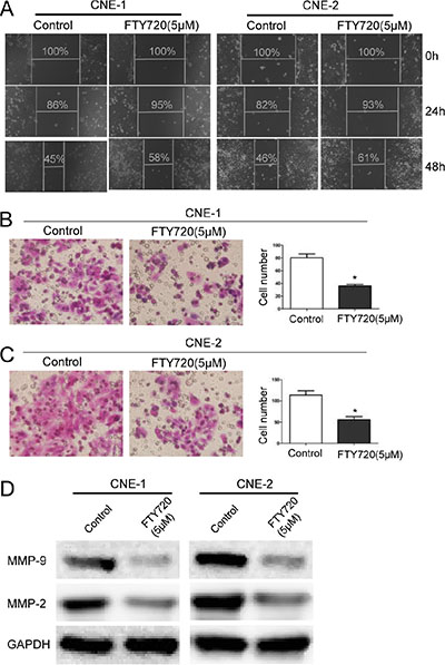 FTY720 inhibits migration in NPC cells.