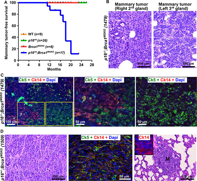 Characterization of primary tumors and distant metastases in mutant mice.