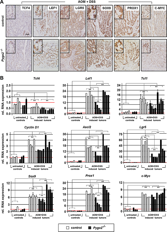 Knockout of Pygo2 downregulates overexpressed Wnt/&#x00DF;-catenin targets and tumor progression genes in a subgroup of Pygo2 deficient chemically induced intestinal tumors.
