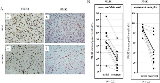 Immunohistochemical analysis of the expression of MLH1 and PMS2 in recurrent human glioblastomas during TMZ treatment.