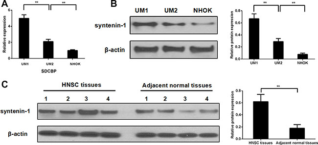 Syntenin-1 was overexpressed in HNSC cell lines and tissues.