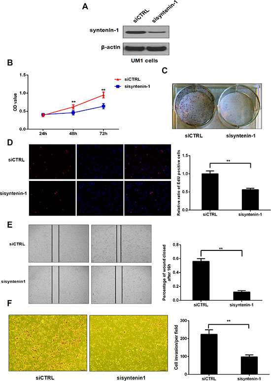 Inhibition of syntenin-1 suppressed the proliferation, migration and invasion capacity of UM1 cells.