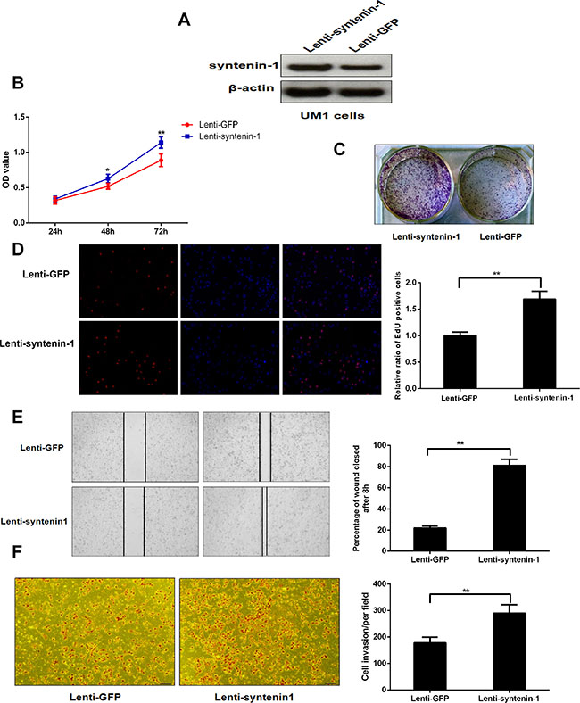 Syntenin-1 overexpression promoted the proliferation, migration and invasion capacity of UM1 cells.