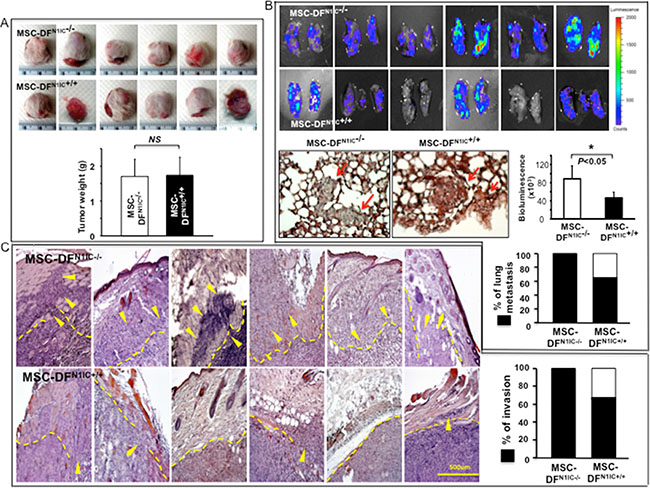 MSC-DFN1IC+/+ selectively inhibit melanoma invasion and metastasis in vivo.