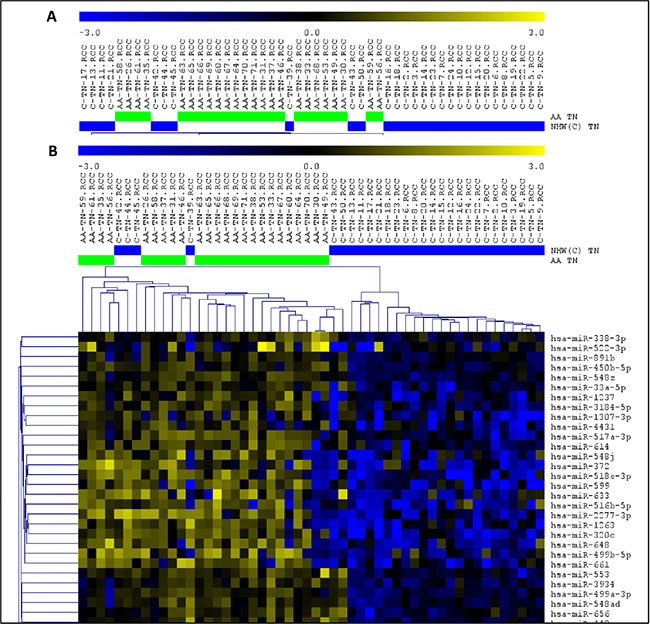 Unsupervised (A) and Supervised (B) Hierarchical Clustering analysis applied to the TNBC cases of the AA (green bars) and NHW (blue bars) group of patients.