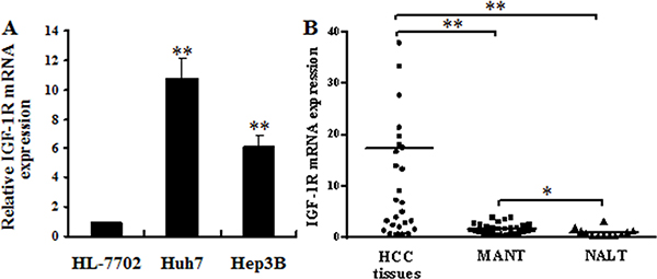 IGF-1R mRNA overexpression in HCC cells and human HCC tissues.