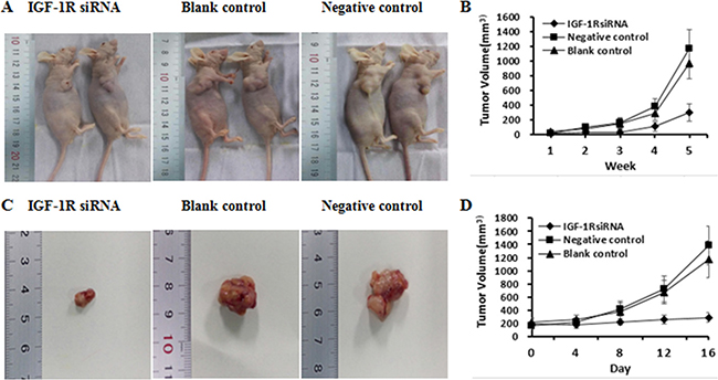 The antitumor effect of IGF-1R silencing on HCC in nude mice models.