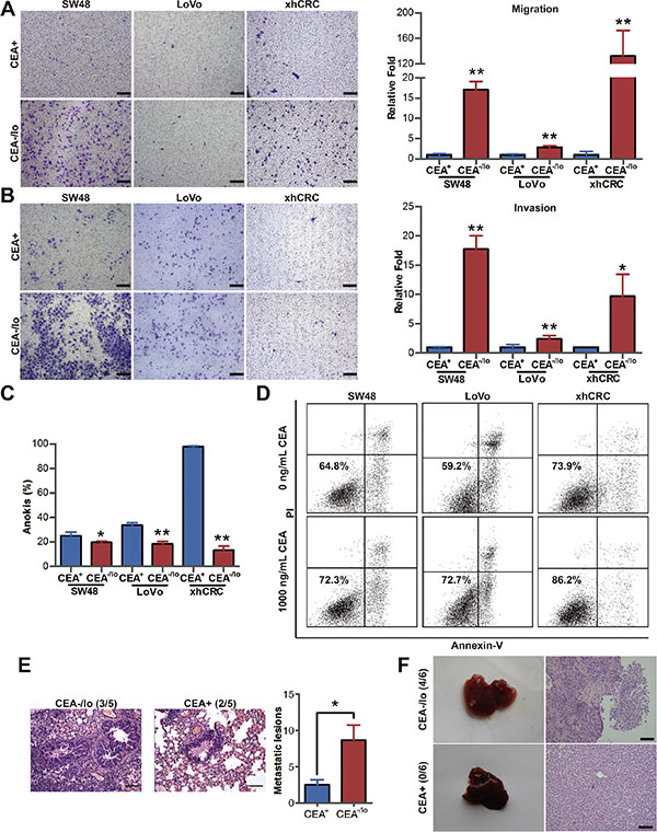 CEA-/lo CRC cells possess higher migration, invasion, anti-anoikis and metastatic capacity.