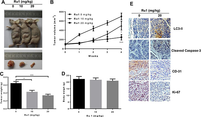 Ru1 inhibites the tumor progression of lung cancer in vivo.