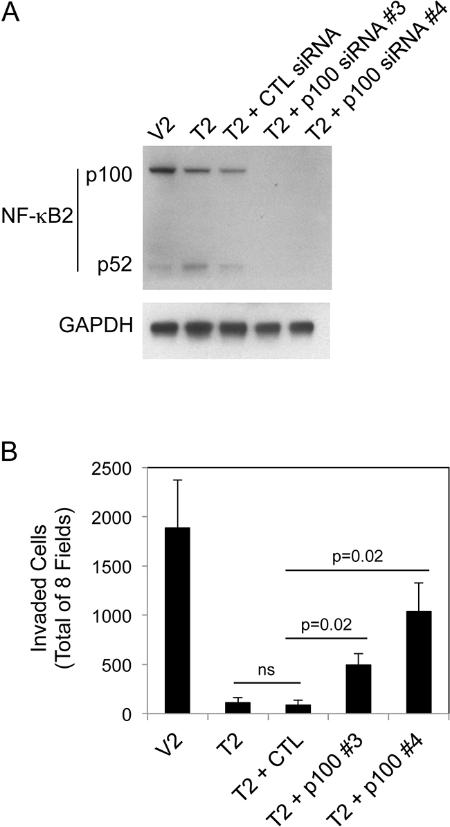NF-&#x03BA;B2 p100 depletion in B16 T2 cells increases cell invasion.