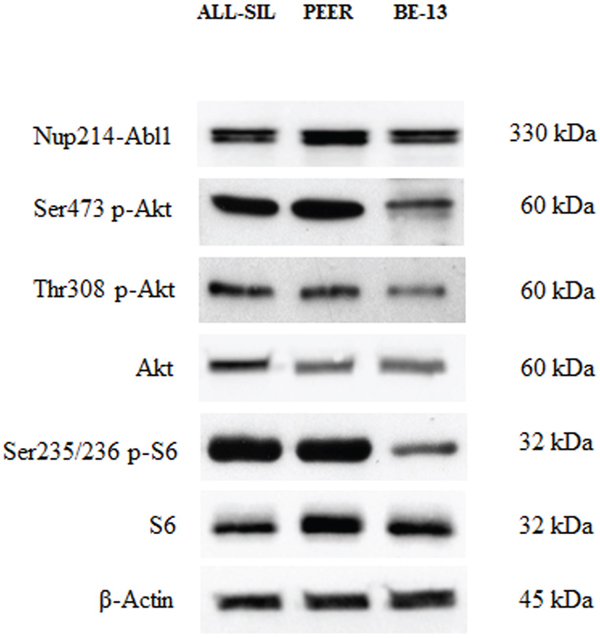 Expression and phosphorylation status of Akt and of the mTORC1 downstream target S6 in NUP214-ABL1 positive T-ALL cell lines.