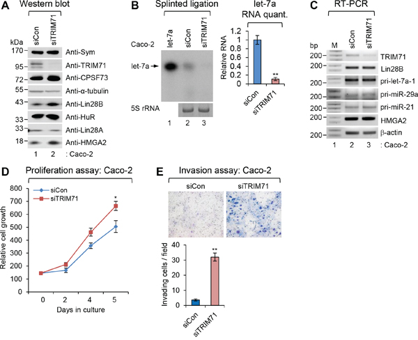 Depletion of TRIM71 promotes proliferation and invasion of colorectal carcinoma Caco-2 cells.