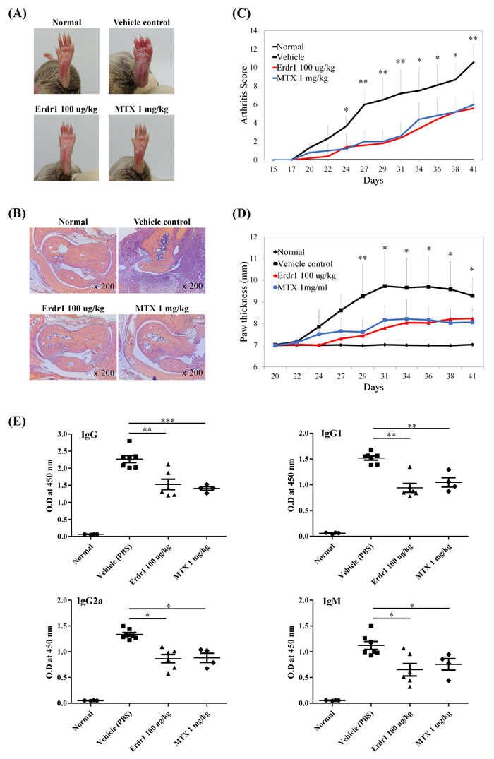 Erdr1 has therapeutic effects on collagen-induced arthritis (CIA)