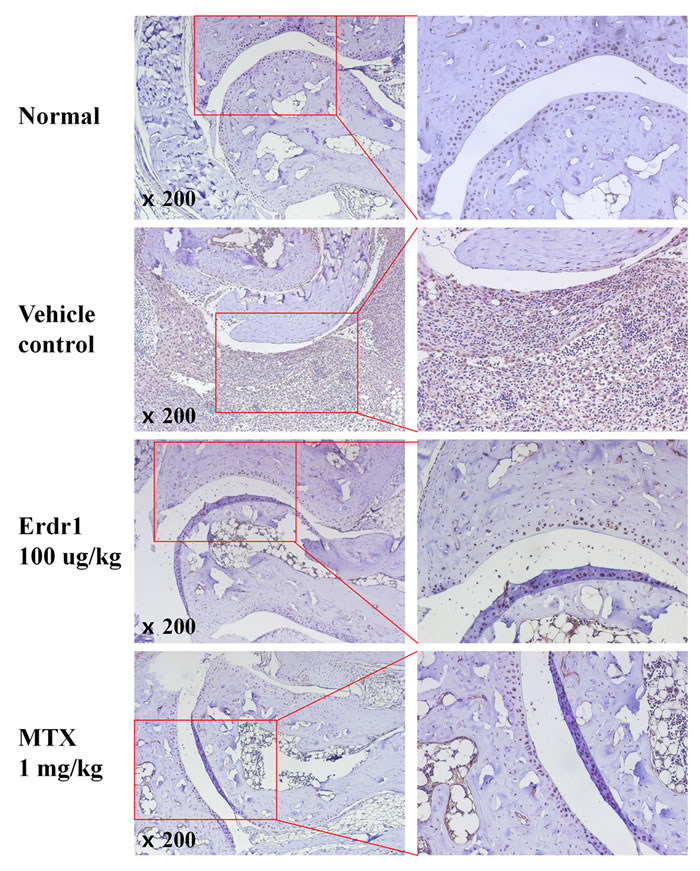 Erdr1 downregulates IL-18 expression in synovial tissue of CIA mice.