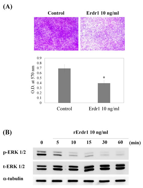 Erdr1 inhibits migration of SW982 synovial fibroblasts by downregulating ERK1/2.
