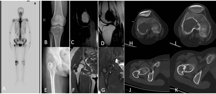 A 27-year-old woman with right knee pain A.