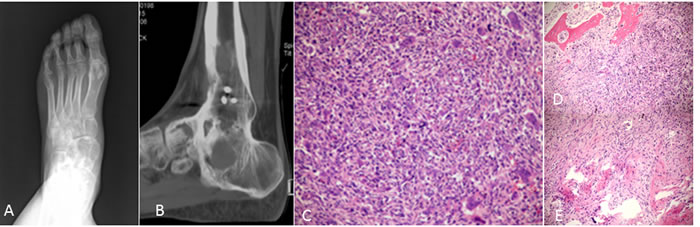 An 18-year-old man presented with pain, swelling and activity limitation.