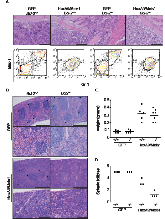 AML transplantation of Bcl-2-defcient cells induced destructive disease in spleen.