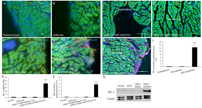The activation of ISL-1 (an early cardiac muscle differentiation marker) in epicardium and sub-epicardial layer after ADM plus UTMD-ANGPTL8.
