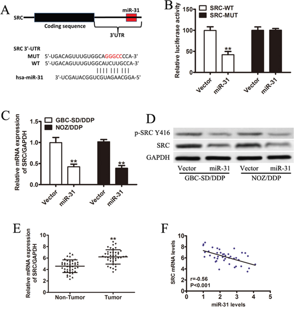 Src is a direct target gene of miR-31 and inversely correlated with miR-31 in GBC patients.