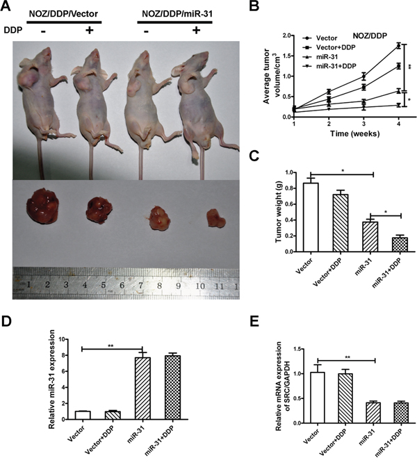 MiR-31 increases chemosensitivity of NOZ/DDP cells in vivo.